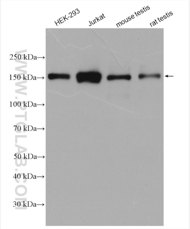 RPGRIP1L Antibody in Western Blot (WB)