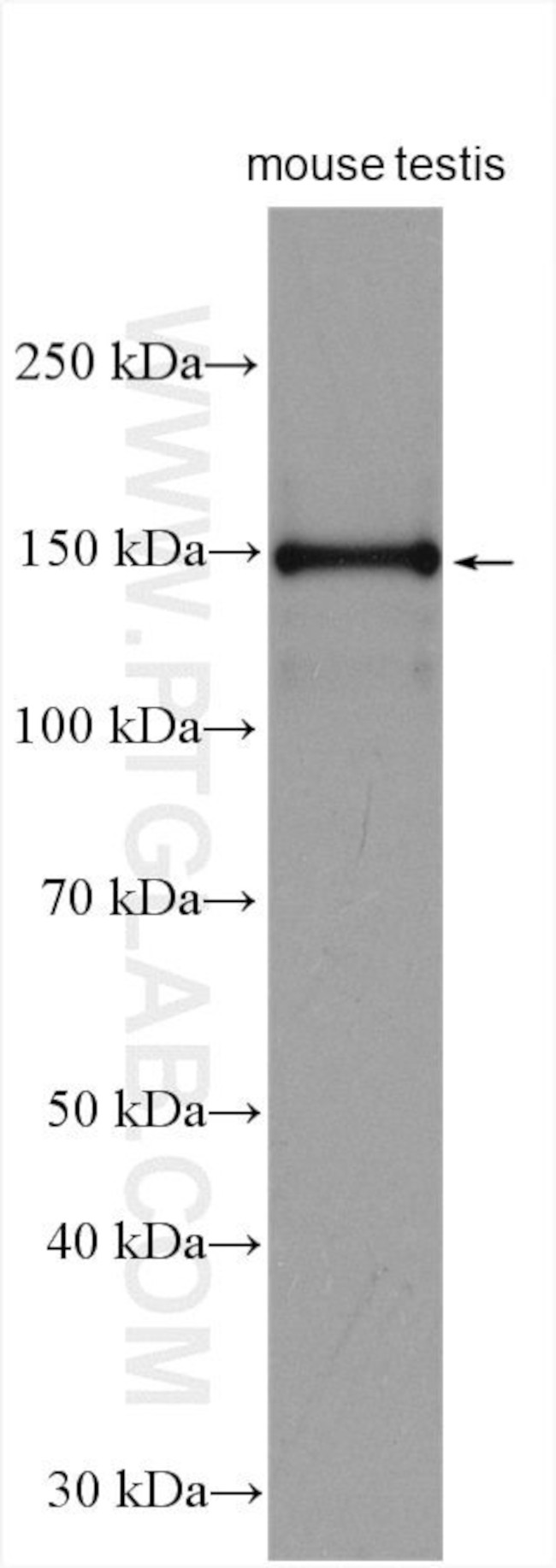 RPGRIP1L Antibody in Western Blot (WB)