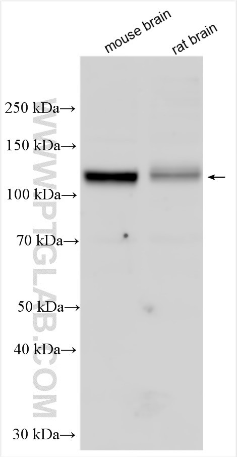 CCDC39 Antibody in Western Blot (WB)