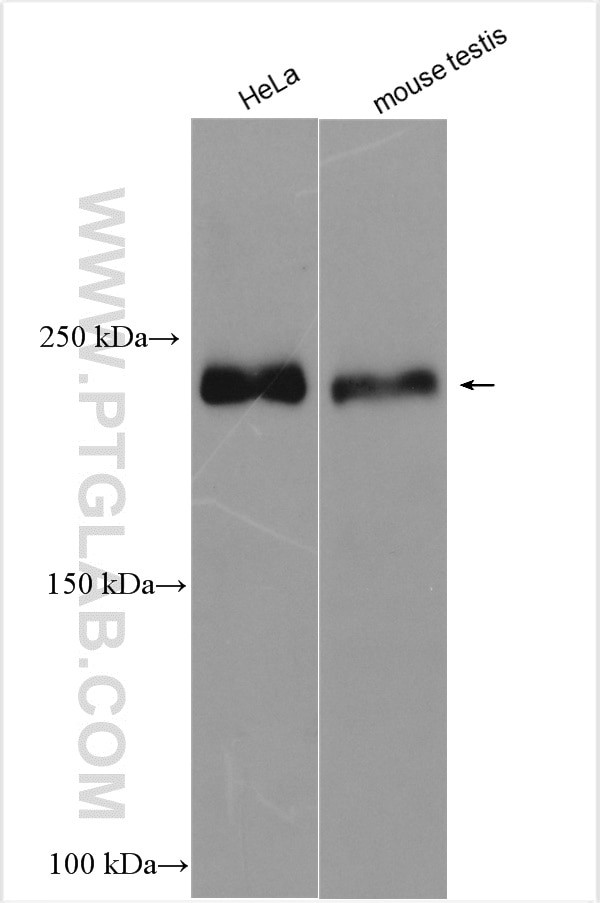 RALGAPA2 Antibody in Western Blot (WB)