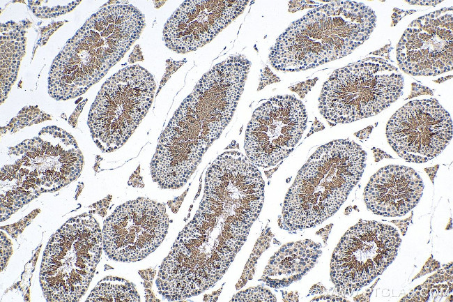 MGC33407/ACTL9 Antibody in Immunohistochemistry (Paraffin) (IHC (P))