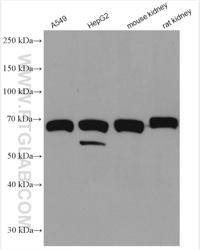 SPATS2L Antibody in Western Blot (WB)