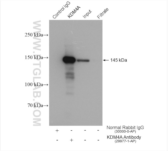 KDM4A Antibody in Immunoprecipitation (IP)