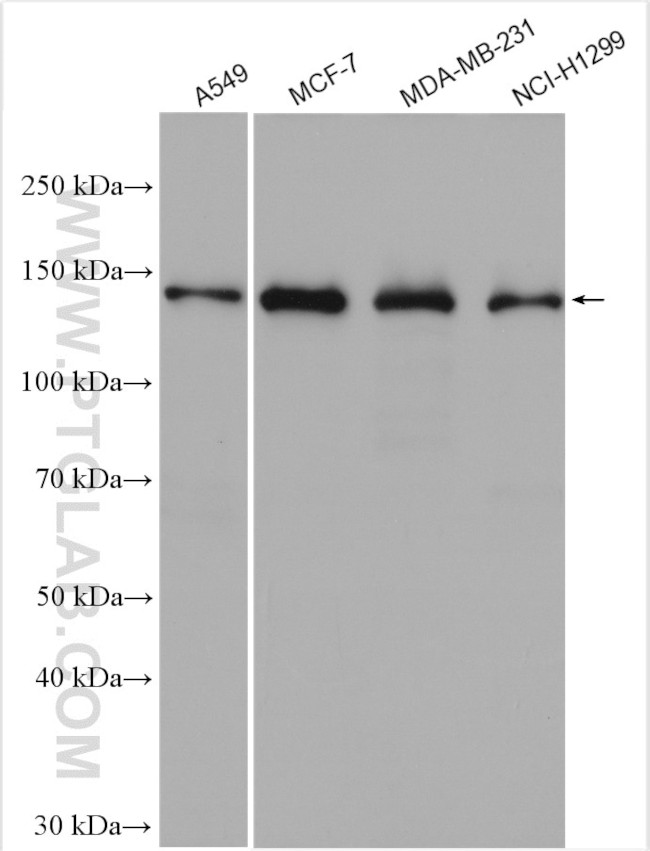 KDM4A Antibody in Western Blot (WB)