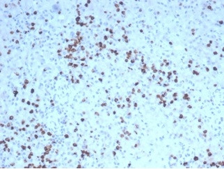 Granzyme B (NK/T-Cell Lymphoma Marker) Antibody in Immunohistochemistry (Paraffin) (IHC (P))