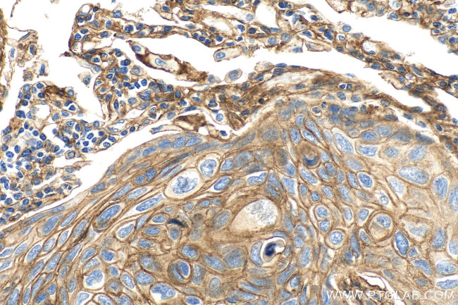 B7-H3 Antibody in Immunohistochemistry (Paraffin) (IHC (P))