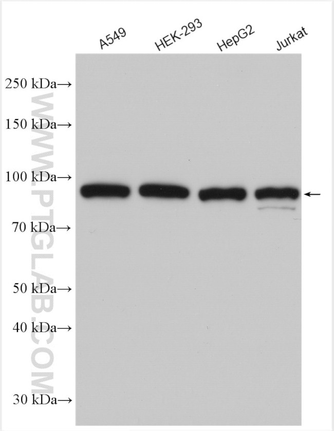P85a/PIK3R1 Antibody in Western Blot (WB)