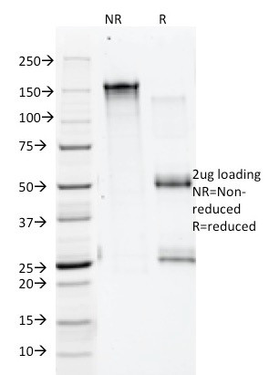 Annexin A1/ (Hairy Cell Leukemia Marker) Antibody in SDS-PAGE (SDS-PAGE)