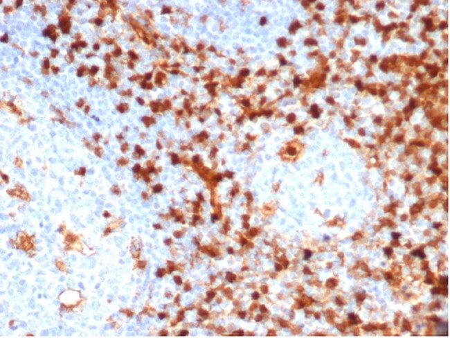 Annexin A1/ (Hairy Cell Leukemia Marker) Antibody in Immunohistochemistry (Paraffin) (IHC (P))