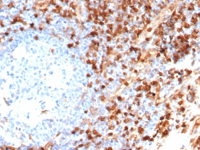 Annexin A1/ (Hairy Cell Leukemia Marker) Antibody in Immunohistochemistry (Paraffin) (IHC (P))