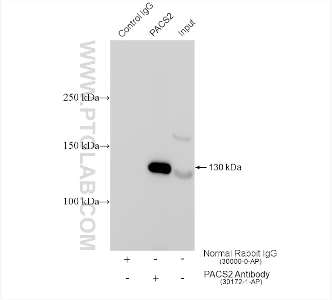 PACS2 Antibody in Immunoprecipitation (IP)