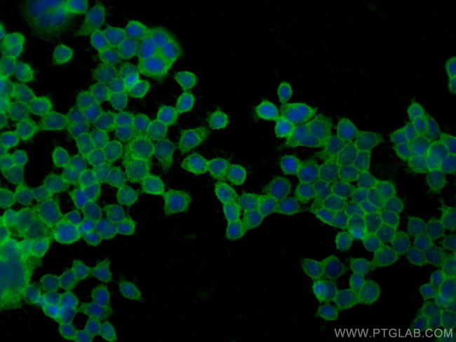 CD59 Antibody in Immunocytochemistry (ICC/IF)