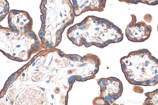 CD59 Antibody in Immunohistochemistry (Paraffin) (IHC (P))