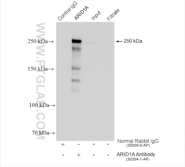 ARID1A Antibody in Immunoprecipitation (IP)