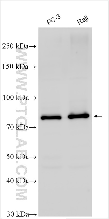 PFKM Antibody in Western Blot (WB)
