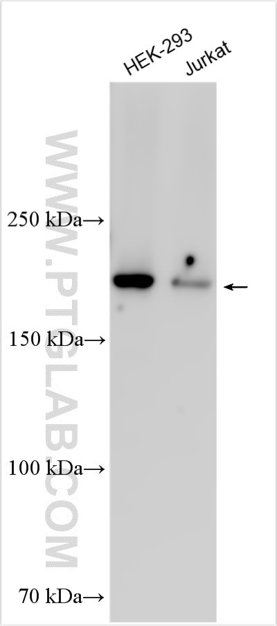SYNJ2 Antibody in Western Blot (WB)