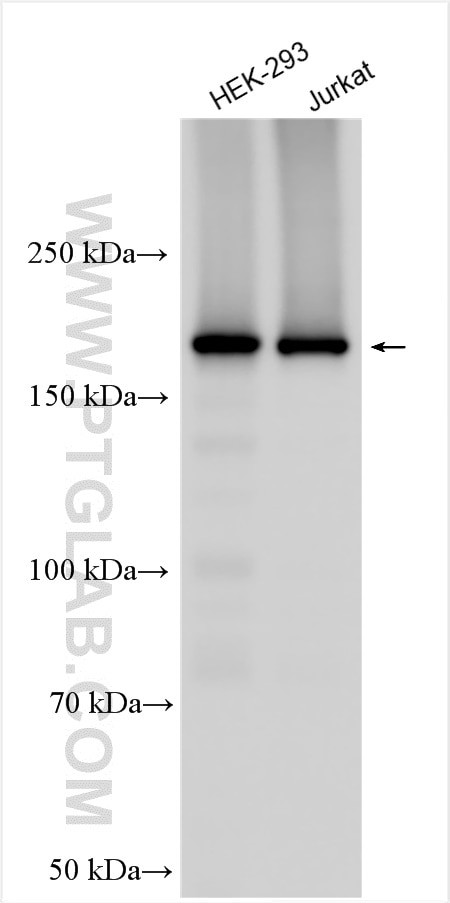 SYNJ2 Antibody in Western Blot (WB)