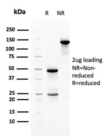 Heregulin-1/Neuregulin-1 (Breast and Urothelial Marker) Antibody in SDS-PAGE (SDS-PAGE)