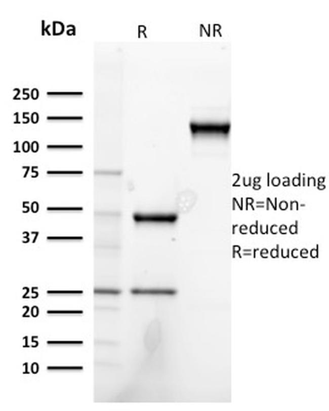 Heregulin-1/Neuregulin-1 Antibody in SDS-PAGE (SDS-PAGE)