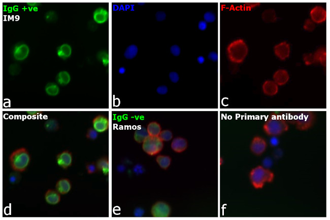 Human IgG (H+L) Cross-Adsorbed Secondary Antibody in Immunocytochemistry (ICC/IF)