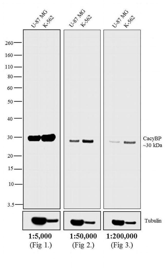 Rabbit IgG (H+L) Secondary Antibody in Western Blot (WB)