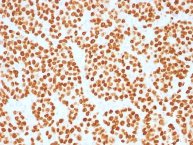 FOXA1/HNF3A Antibody in Immunohistochemistry (Paraffin) (IHC (P))