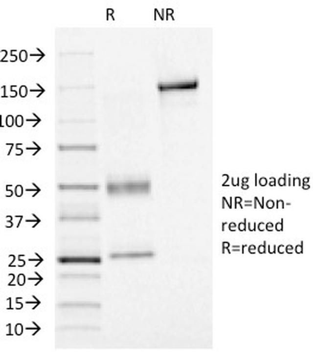 FOXA1/HNF3A Antibody in SDS-PAGE (SDS-PAGE)