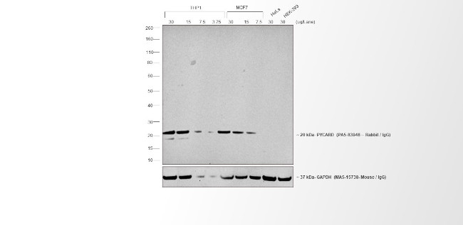 Rabbit IgG (H+L) Poly-HRP Secondary Antibody in Western Blot (WB)