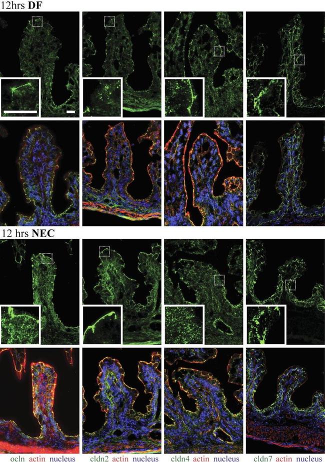 Claudin 4 Antibody in Immunohistochemistry (IHC)