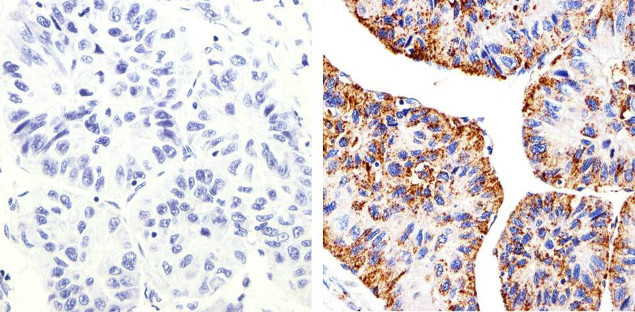 Claudin 2 Antibody in Immunohistochemistry (Paraffin) (IHC (P))