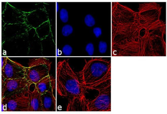 PKP1 Antibody in Immunocytochemistry (ICC/IF)