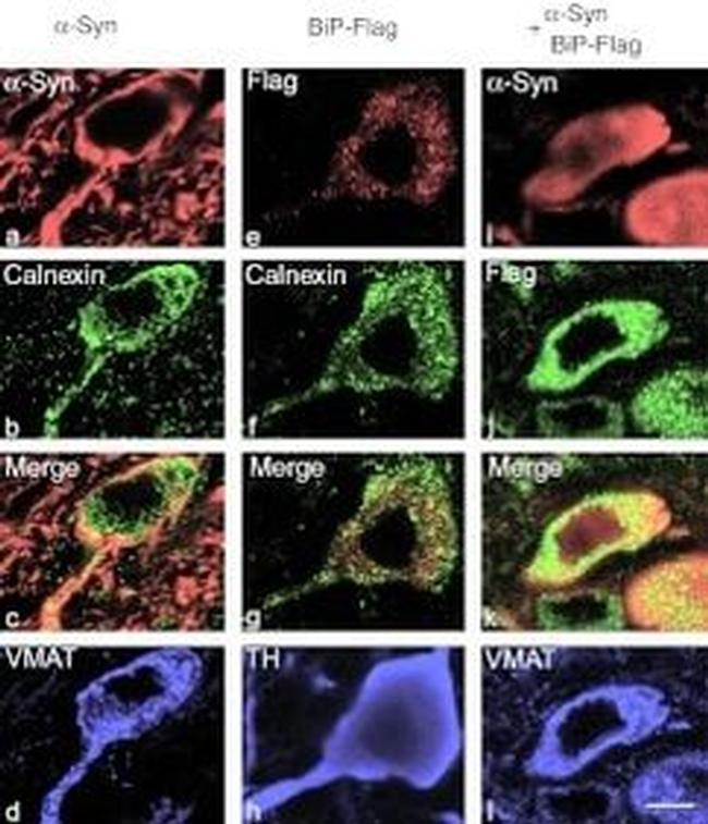 alpha Synuclein Antibody in Immunohistochemistry (IHC)