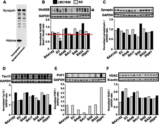 alpha Synuclein Antibody in Western Blot (WB)