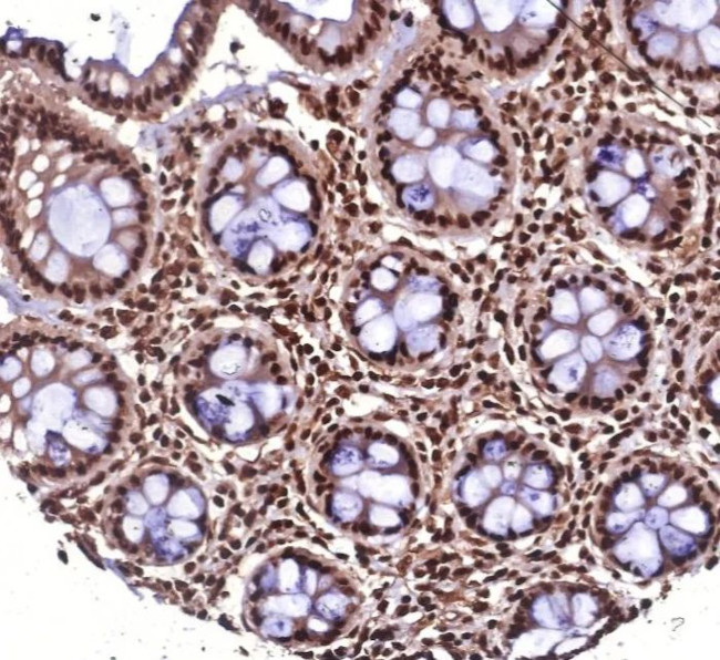 Heat shock 70 kDa protein 1B (HSPA1B) Antibody in Immunohistochemistry (Paraffin) (IHC (P))