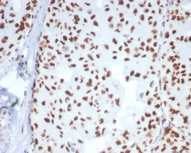 Heat shock 70 kDa protein 1B (HSPA1B) Antibody in Immunohistochemistry (Paraffin) (IHC (P))