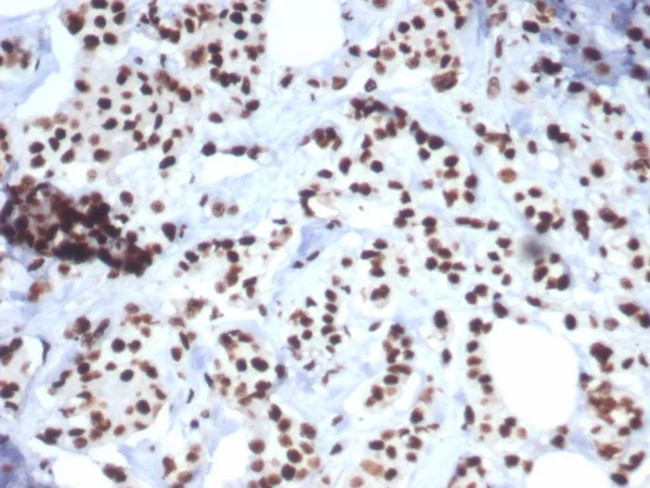 Heat shock 70 kDa protein 1B (HSPA1B) Antibody in Immunohistochemistry (Paraffin) (IHC (P))