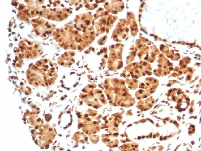 Heat shock 70 kDa protein 1B (HSPA1B) Antibody in Immunohistochemistry (Paraffin) (IHC (P))