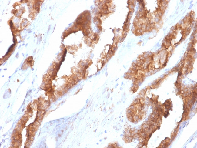 Heat Shock 27kDa Protein 1 Antibody in Immunohistochemistry (Paraffin) (IHC (P))