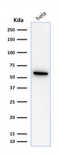 HSP60 (Heat Shock Protein 60) (Mitochondrial Marker) Antibody in Western Blot (WB)