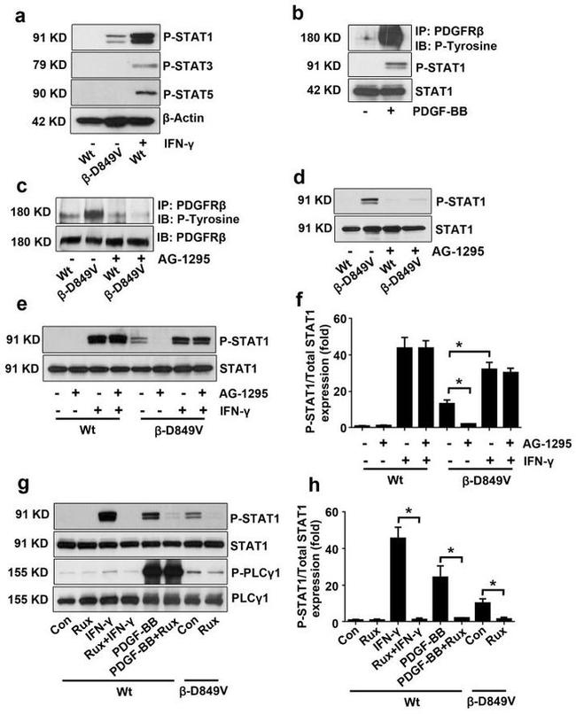 Phospho-STAT1 (Tyr701) Antibody in Western Blot (WB)