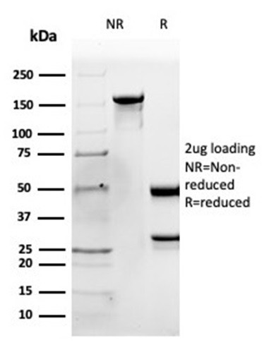 Apolipoprotein B/APOB Antibody in SDS-PAGE (SDS-PAGE)