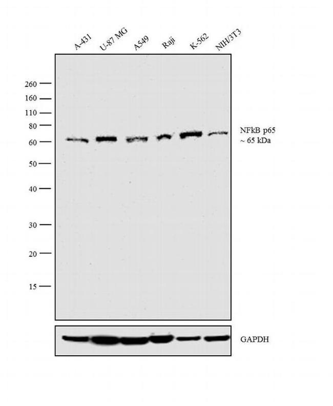 Western blots show p65 antibodies that passed the test of specificity