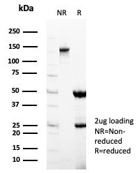 STING1/TMEM173 Antibody in SDS-PAGE (SDS-PAGE)