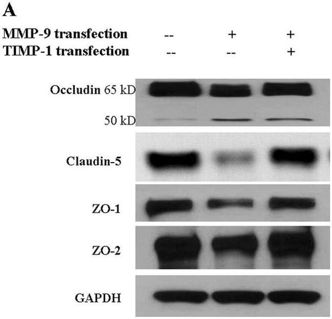 ZO-1 Antibody in Western Blot (WB)