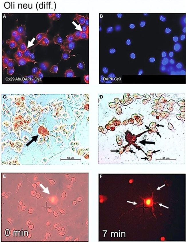 Connexin 29 Antibody in Immunocytochemistry (ICC/IF)