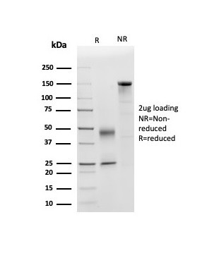 Apolipoprotein D/APO-D Antibody in SDS-PAGE (SDS-PAGE)