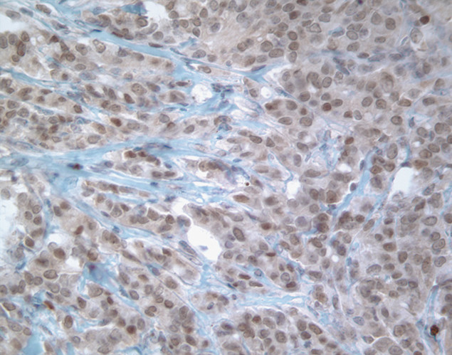 MGMT Antibody in Immunohistochemistry (IHC)