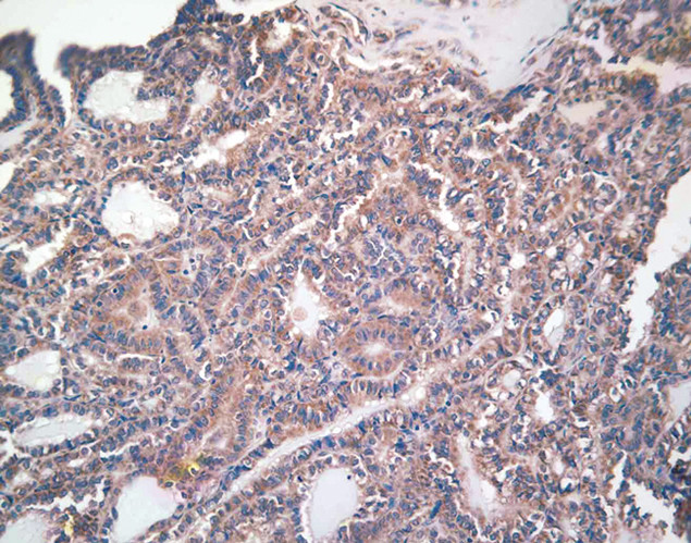 COX1 Antibody in Immunohistochemistry (IHC)