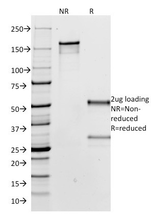 IgG (Immunoglobulin Gamma Heavy Chain) (B-Cell Marker) Antibody in SDS-PAGE (SDS-PAGE)