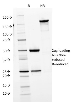 IgM (Immunoglobulin Mu Heavy Chain) (B-Cell Marker) Antibody in SDS-PAGE (SDS-PAGE)